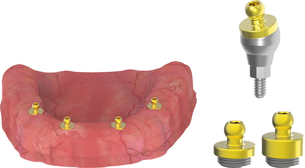 ball-abutment-kapali-kasik