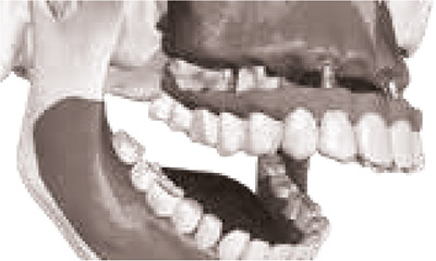 gecicinin-yerlestirilmesi