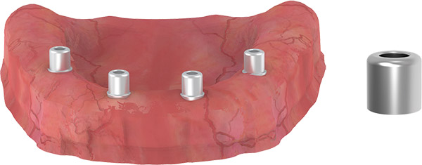 Immediate Restorasyon