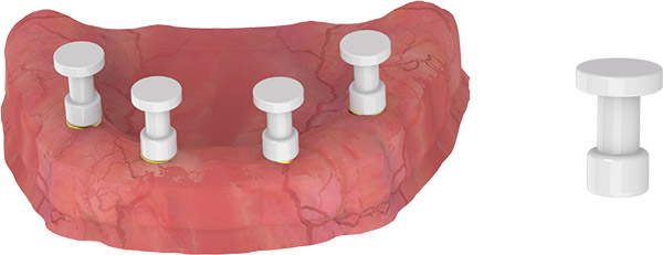 locator-abutment-kapali-kasik-1