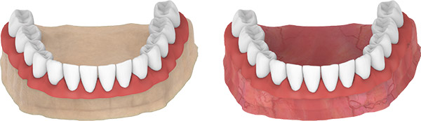 locator-abutment-laboratuvar-prosesleri-1