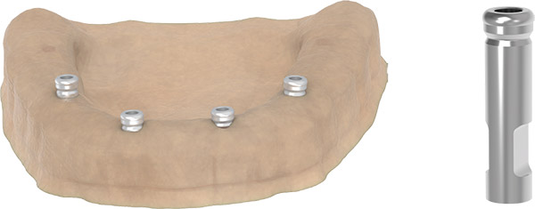 locator-abutment-laboratuvar-prosesleri