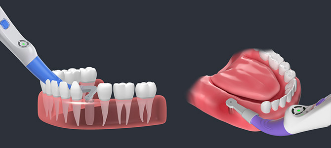 implant-detector-2